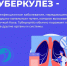 Туберкулез.png - Газета Перекресток России